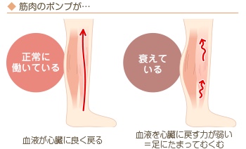 むくみの原因②運動不足
