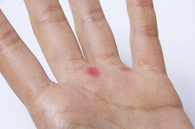 鉄棒筋トレにあると効果的なグローブ
